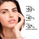 Dermocosmetica-Anti-acne_Vichy_Pasteur_460074_frasco_03