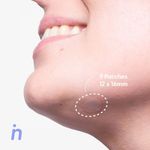 Hogar-Otras-variedades_Nipskin_Pasteur_1439006_bolsa_02