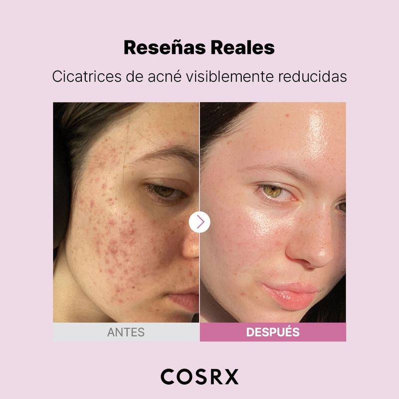 Dermocosmetica-Despigmentantes_Cosrx_Pasteur_1508002_frasco_04